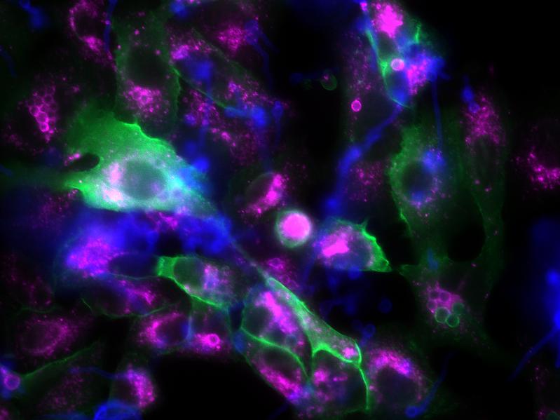 Das fluoreszenzmikroskopische Bild zeigt Epithelzellen (große, unregelmäßige Strukturen) und Pilzsporen (kleine, kugelige Strukturen). Sind die Pilzsporen von p11 umgeben, erscheinen sie grün, reife Phagosomen erscheinen violett.