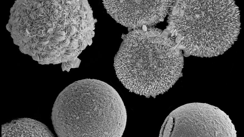 Schalen von L. granifera-Algen nach chemischer Transformation, abgebildet mit dem Elektronenmikroskop.