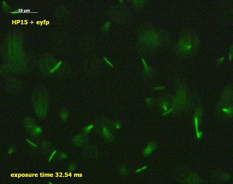Marine bacteria tagged with fluorescence are investigated in the laboratory for chemotaxis using a microscope. 