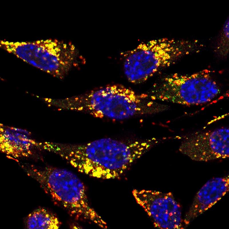 Hautzellen der Maus mit blau gefärbtem Zellkern. Die Lysosomen wurden rot, ein neu entdecktes lysosomales Protein grün angefärbt. Wo beide zusammen vorkommen, resultiert das in einer Gelbfärbung. 