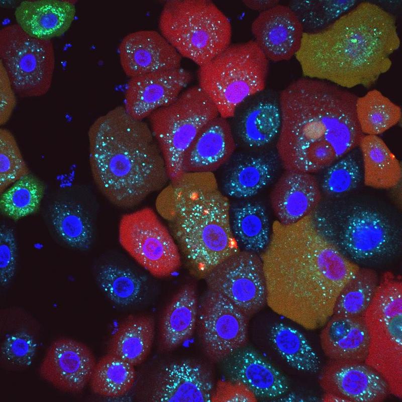 Werden die Mitochondrien (hellblau) geschädigt, schlägt der NLRP10-„Rauchmelder“ Alarm und formiert sich mit anderen Proteinen zu einem Inflammasom (rot). Letztlich führt das zum Untergang der Zelle und ihrer Entsorgung. 