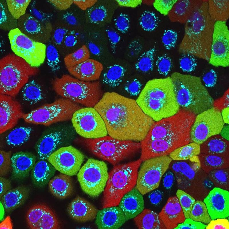 Human skin cells with "healthy" mitochondria (light blue): The NLRP10 "smoke detector" (yellow-green) is distributed over the entire contents of the cell, apart from the nucleus (blue-violet). 