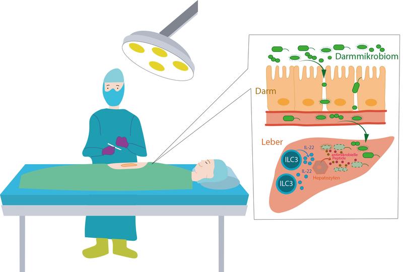 Nach einem operativen Eingriff können Bakterien aus dem Darm in den Organismus gelangen. Spezielle Zellen des Immunsystems, die in der Leber ansässig sind, bekämpfen sie.