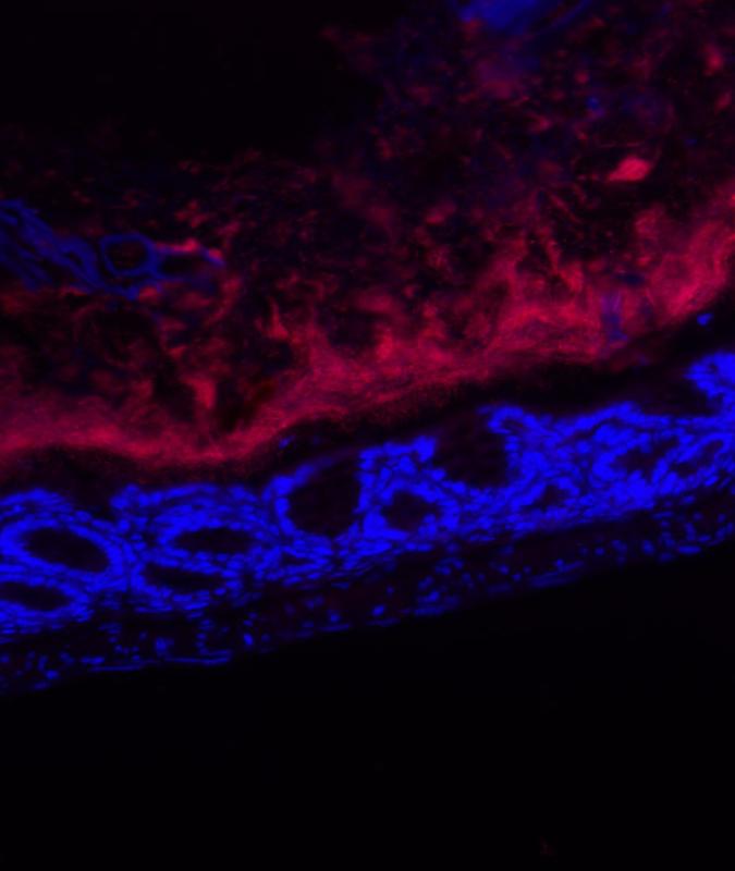 Die Mikrobiota des Darms unter dem Mikroskop. Rot gefärbt sind die Bakterien zu sehen, der Darm ist blau.
