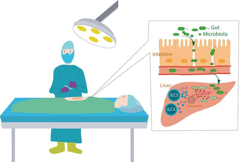 After surgery, bacteria from the intestine can enter the organism. Special cells of the immune system located in the liver fight them. 