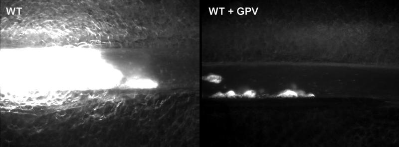 Behandlung einer Maus mit löslichem GPV verhindert die Bildung eines gefäßverschließenden Thrombus im experimentellen Modell zur Thrombosebildung (rechts). Im Vergleich dazu ist ein gefäßverschließender Thrombus einer unbehandelten Maus gezeigt (links)