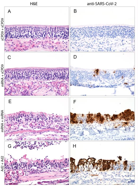 Nach zweifacher Impfung mit dem Lebendimpfstoff (A) verändert SARS-CoV-2 die Nasenschleimhaut der Hamster kaum (B). Die Kombination aus Lebend- und mRNA-Impfstoff (C) ist auch sehr effektiv; kleine Angriffsflächen (braun) findet das Virus aber (D).