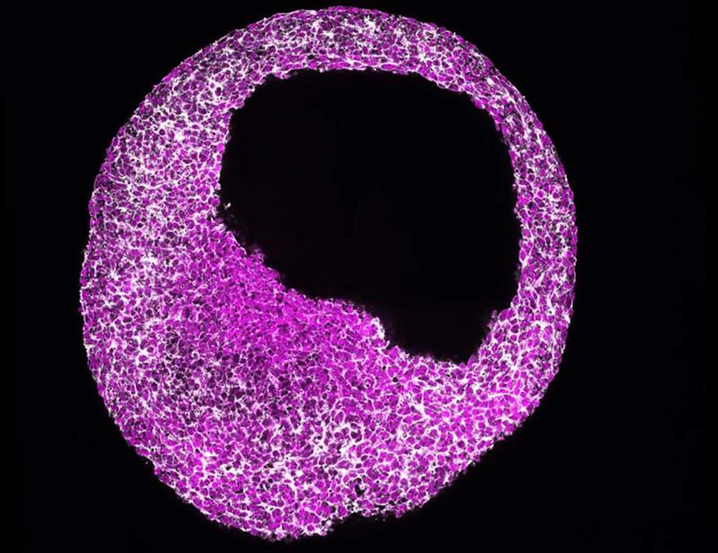 Modell: Menschliches Herzorganoid (Cardioid), das die Forscher zur 3D-Rekonstruktion der menschlichen Herzentwicklung verwendeten. Menschliches Cardioid im kardialen Mesoderm-Stadium, sichtbar gemacht mit Phalloidin (grau) und β-Catenin (magenta).