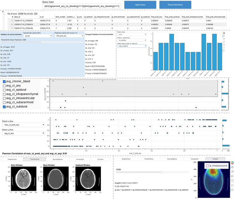 The ScrutinAI tool is used to detect errors in AI models or training data and to analyze the causes. In this example, an AI model for detecting abnormalities and diseases in CT images is being studied.