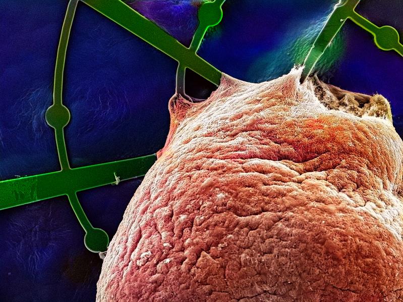 A human brain organoid (colored red) grew on the hammock-like mesh structure of a Mesh-MEA (green) for one year. The scanning electron micrograph shows how the brain organoid has grown around the mesh filaments and microelectrodes.