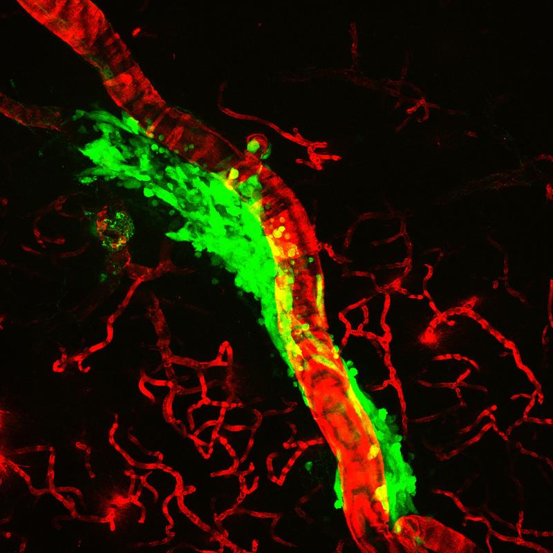 Tumorzellen (grün) wachsen entlang von Blutgefäßen (rot) invasiv ins Gehirngewebe ein.