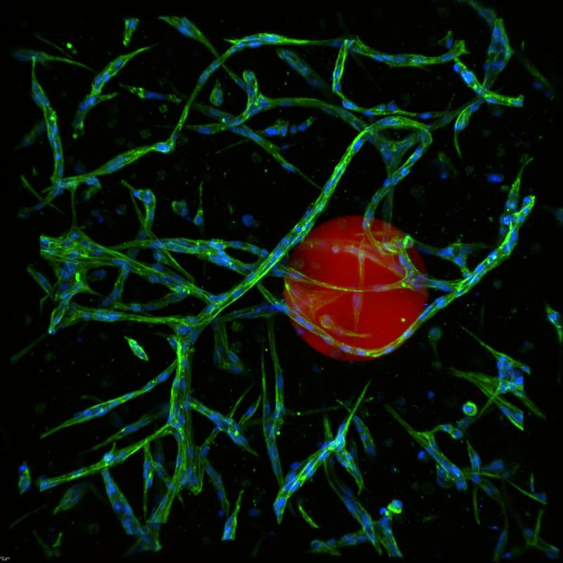 Bildung eines Endothelzellnetzes um ein mit Morphogenen beladenes starPEG-Heparin-Mikrogel