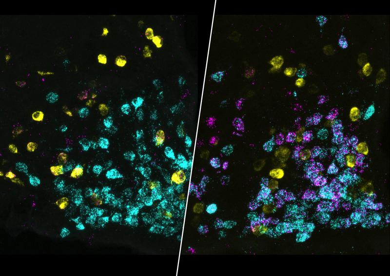 AgRP neurons in the brain are activated by fasting. The images show immunostaining of neurons from mice that fast for 4 hours (right) and mice that do not fast (left). 