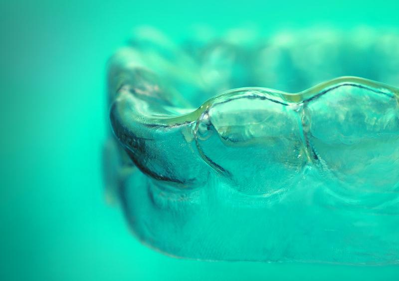 Mit Alignern aus Formgedächtnispolymeren kann die Anzahl kieferorthopädischer Zahnschienen im Verlauf einer Therapie reduziert werden.