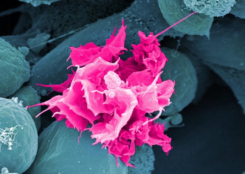 Das Bild aus dem Rasterelektronenmikroskop zeigt eine Langerhanszelle (pink) bei der Auswanderung aus der Epidermis zu den Lymphknoten in 15.000facher Vergrößerung.