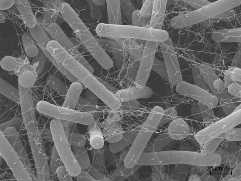 Elektronenmikroskopische Aufnahme von Clostridioides difficile.