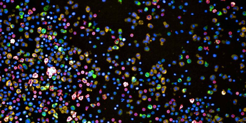 Zellen aus einer Knochenmarksbiopsie eines Patienten mit Multiplem Myelom. Rot gefärbt sind gesunde T-Zellen respektive Monozyten, grün und gelb die Plasmazellen.
