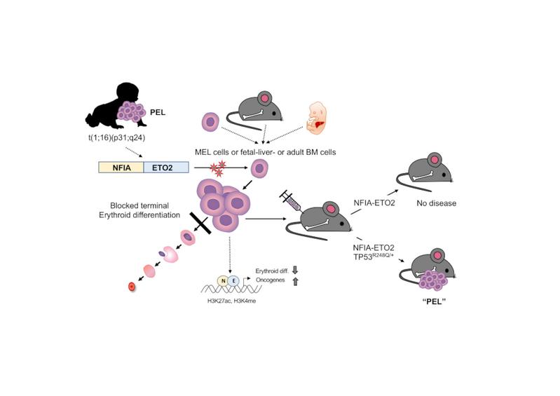 Piqué et al. fanden, dass die mit kindlicher Erythroleukämie («PEL»)-assoziierte NFIA-ETO2 Fusion die Ausreifung erythroider Zellen durch Veränderung der Genexpression blockiert, und zusammen mit einer TP53 Genmutation eine PEL in der Maus auslösen kann. 