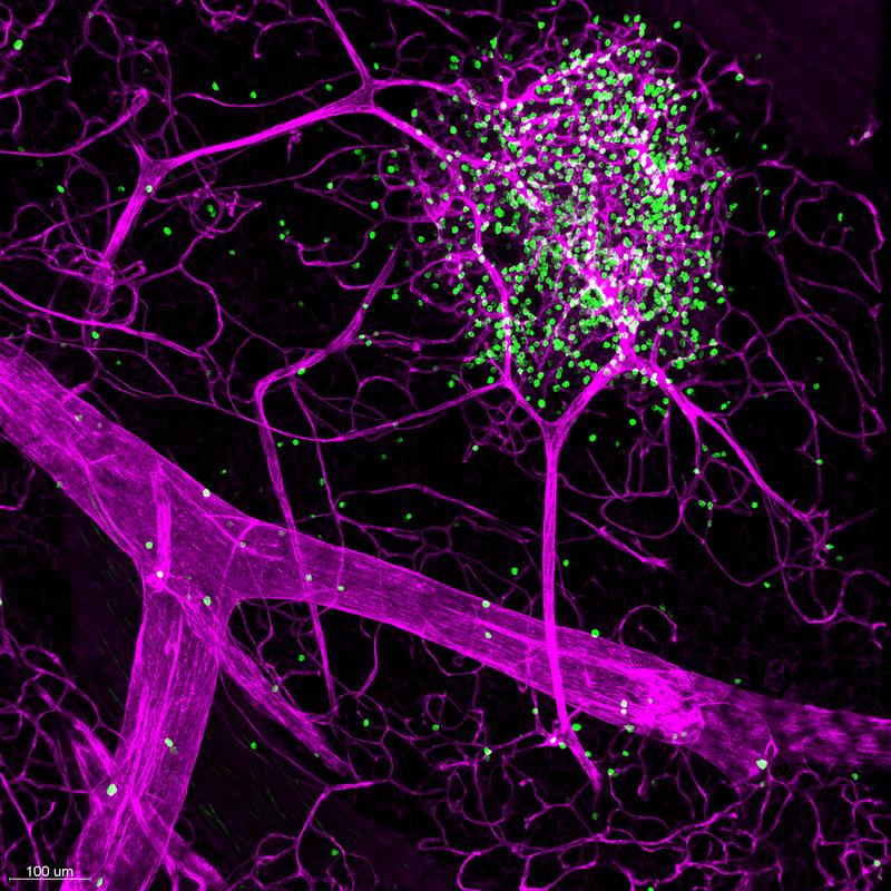 Mikroskopieaufnahme: Das Immunsystem wird in mikroskopischen Strukturen sichtbar – die Wirkung der Forschung auf die Gesundheit ist umso größer. 