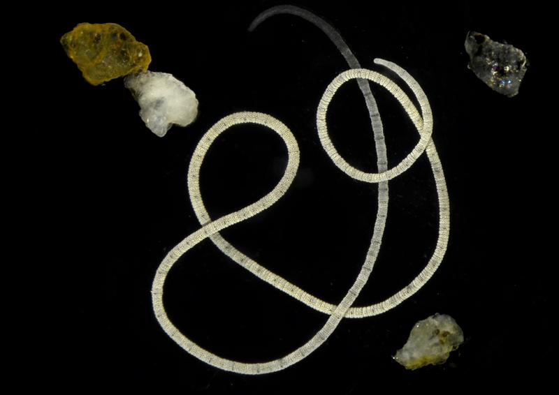 Der darmlose marine Wurm Olavius algarvensis unter dem Mikroskop. Es ist etwa zwei Zentimeter lang und misst nur einen halben Millimeter im Durchmesser. Es lebt zwischen Sandkörnern (im Bild zu erkennen) an Seegraswiesen im Mittelmeer. 