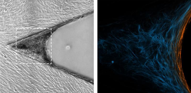 Zellen füllen den nach rechts offenen Spalt mit neuem Gewebe. In oranger Farbe sieht man die Myofibroblasten in der «Wachstumsfront» (Mikroskopieaufnahmen).