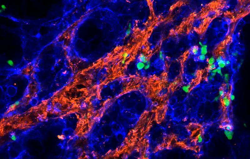 Fluoreszenzmikroskopische Aufnahme von Gamma-Delta-T-Zellen (grün), die Krebszellen (blau) angreifen. Dafür müssen die Immunszellen durch ein Gewebegeflecht wandern, das den Tumor umgibt (rot).