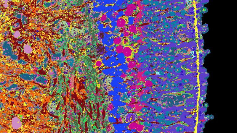 Ausschnitt aus einem Querschnitt eines Netzhaut-Organoids. Unterschiedliche Gewebestrukturen sind mit unterschiedlichen Farben sichtbar gemacht.