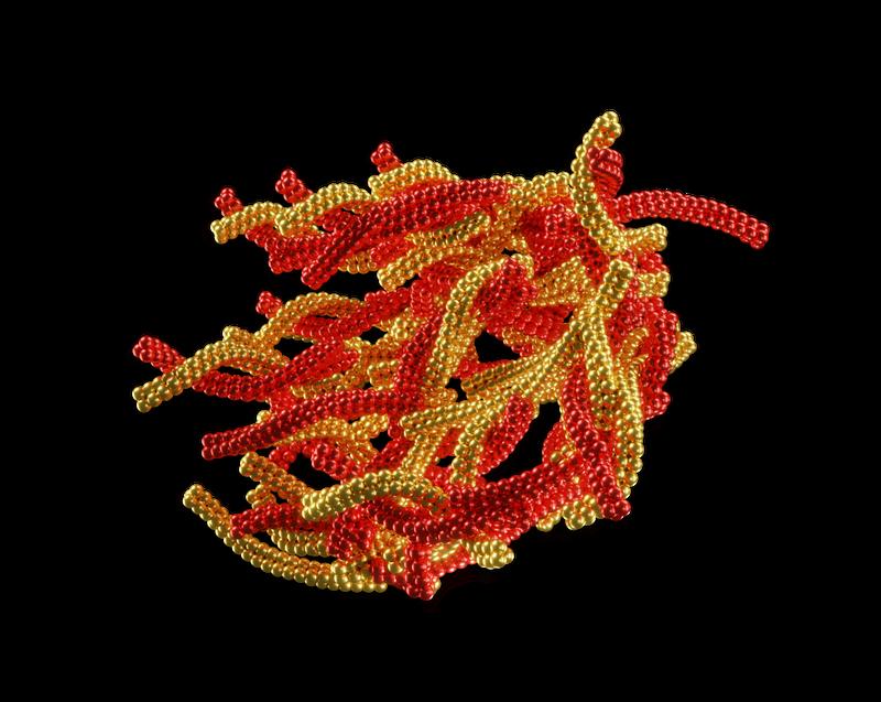 Bei Alzheimer verknäulen sich Eiweissfasern im Gehirn zu Plaques. Die Anhäufung derartiger Knäuel führt zum Absterben von Nervenzellen und Ausfällen in der Denkleistung.
