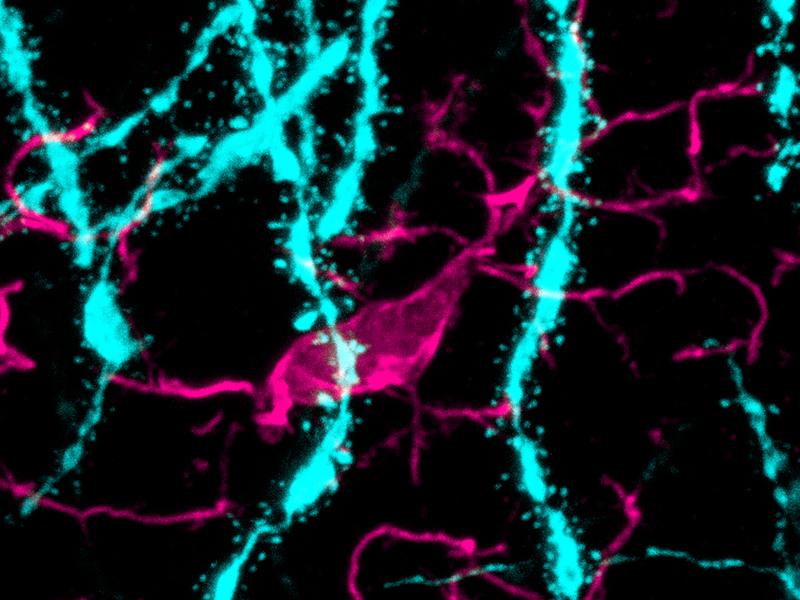 Ein verstärkter Abbau dendritischer Dornfortsätze von Nervenzellen (türkis) durch spinnenförmige Mikrogliazellen (pink) lässt sich im Gehirn männlicher Mäuse nach Immunstimulation beobachten.