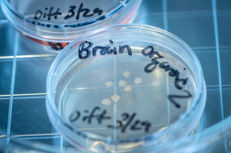      Gehirn-Organoide im Labor von Prof. Dr. Simon T. Schäfer