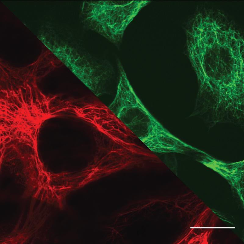 Mikroskopiebilder von biologischen Zellen: rechts oben (grün): Vimentin-Intermediärfilamente in Fibroblasten, links unten (rot): Keratin-Intermediärfilamente in Epithelzellen. Maßstab: 10 µm.