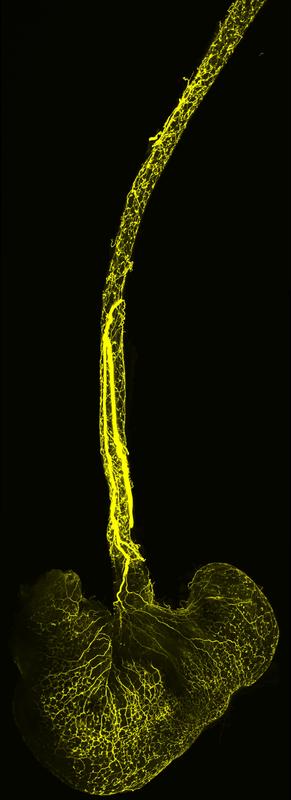 Speiseröhre und Magen einer Maus: Die Fortsätze der sensorischen Neuronen, die zu einem Zellknoten des Vagusnervs (vagales Ganglion) gehören, sind gelb markiert. Ein mesoSPIM-Mikroskop macht die Axone sichtbar.