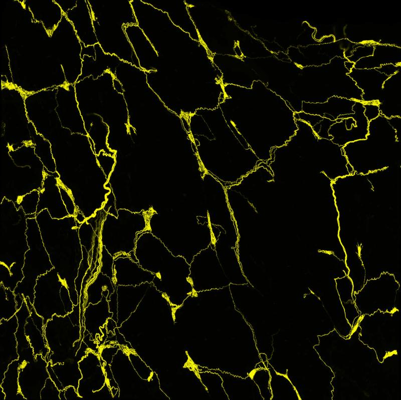 Konfokale Mikroskop-Aufnahme: Die Axone der sensorischen Nervenzellen bilden ein feines Netzwerk in der Speiseröhre der Maus. Die Fortsätze der sensorischen Neuronen, die zu einem Zellknoten des Vagusnervs (vagales Ganglion) gehören, sind gelb angefärbt.