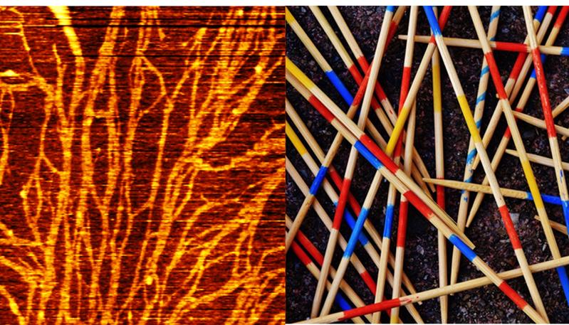 FUS-Proteine bilden zusammenhängende "Mikado-Netzwerke“. Diese könnten ein Baustein bei der Entstehung neurodegenerativer Krankheiten sein.