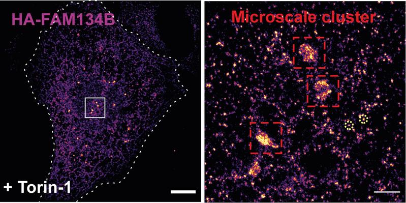 Cluster von Membrankrümmungsrezeptoren in der ER-Membran  Mit einer super-hochauflösenden Mikroskopietechnik lässt sich erkennen, wie sich nach Stimulation von ER-Phagie im Endoplasmatischen Retikulum FAM134B-Proteine zu Clustern zusammenfinden.