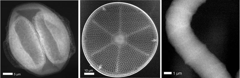 Von links nach rechts: Ein bei DESY gesammeltes Pollenkorn, eine Kieselalge und ein Cyanobakterium, alle abgebildet mit Compton-Röntgenstreuungsmikroskopie an DESYs Röntgenlichtquelle PETRA III. 