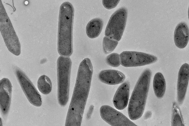 Das Bakterium Clostridium ljungdahlii unter dem Elektronenmikroskop.