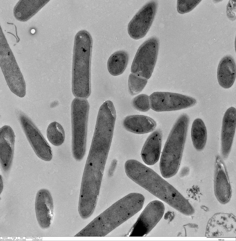 Electron microscope image of the bacterium Clostridium ljungdahlii. 