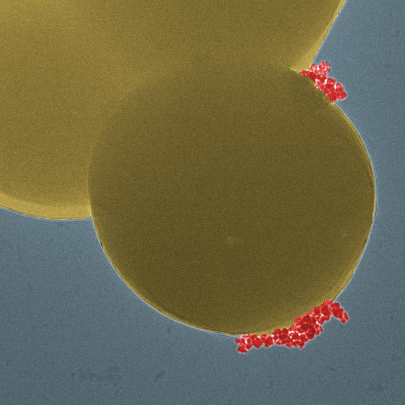 Die Magnet-Nanopartikel (rot) binden spezifisch an die rund 1 µm grossen Bakterien (gelb) (Elektronenmikroskopie digital koloriert)