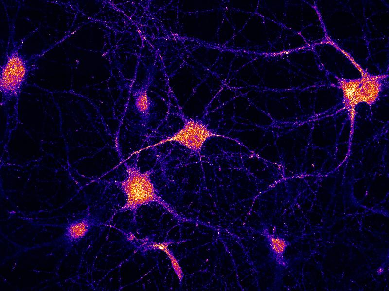 Lokalisierung des FERRY-Komplexes in Neuronen.