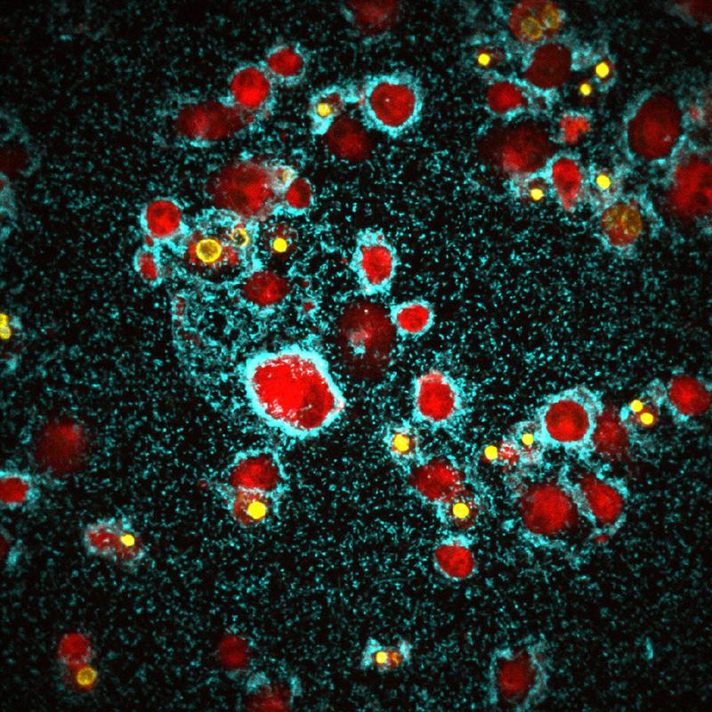Der Cholera-Erreger Vibrio cholerae (blau) bildet auf der Oberfläche von Immunzellen (rot) einen aggressiven Biofilm.