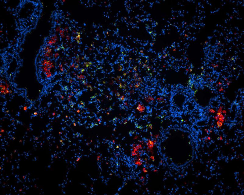 Die Mikroskopaufnahme eines Lungenschnittes einer mit TB infizierten Maus zeigt in Rot die Wirkstoff-Nanopartikel. Ausführliche Bildunterschrift am Textende. (Abbildung: FZB Zelluläre Mikrobiologie, Dr. N. Redinger).