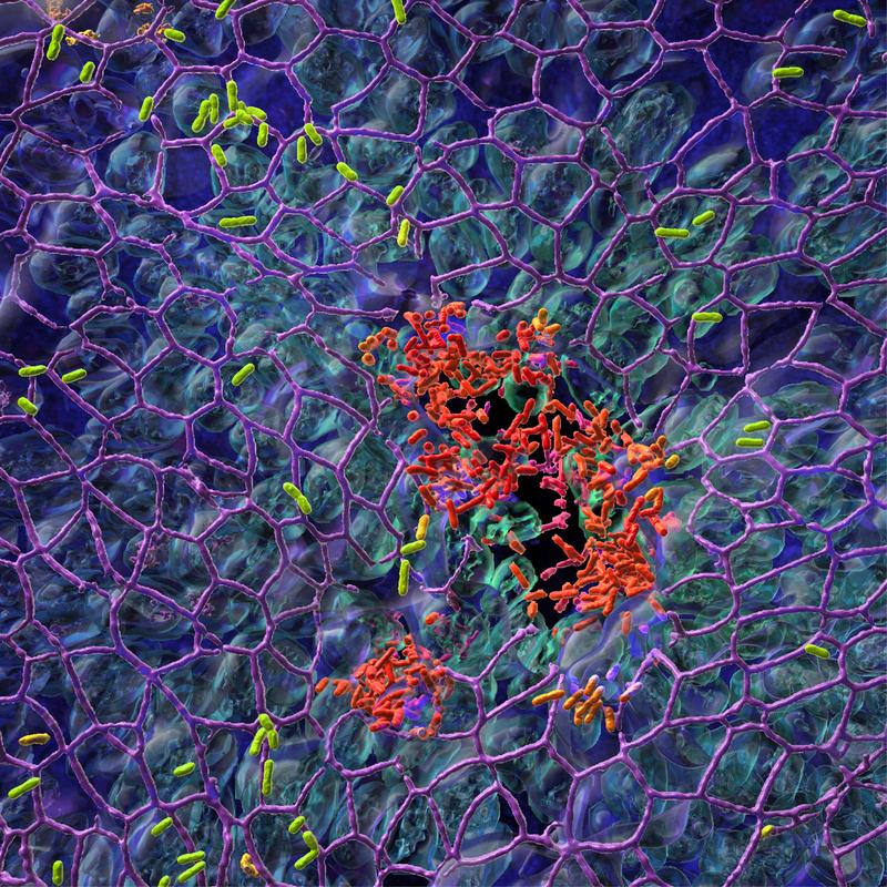Der Spitalkeim Pseudomonas aeruginosa besiedelt die Schleimhaut der Lunge (blau), indem er zwei verschiedene Populationen bildet – sesshafte (rot) und bewegliche (grün) Bakterien.