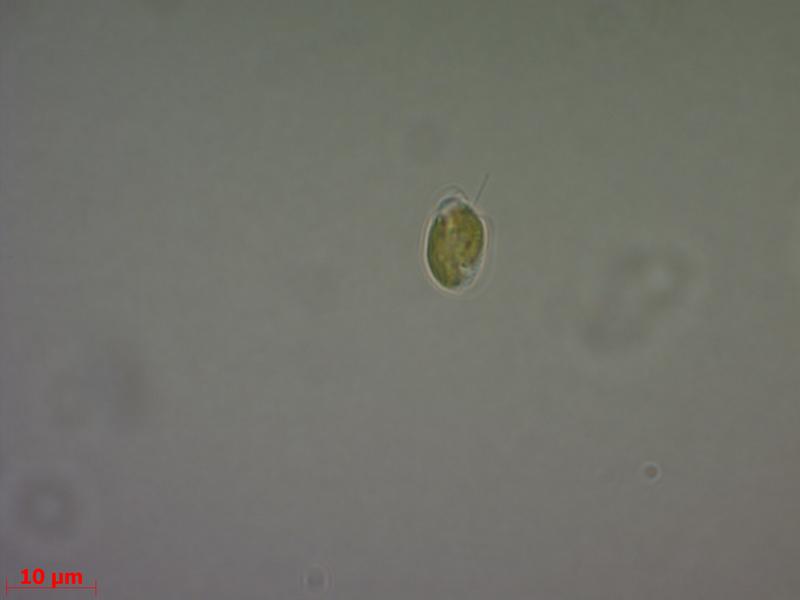 Lichtmikroskopische Aufnahmen einer Zelle von Prymnesium parvum aus den Anreicherungskulturen. Die Zelle zeigt Geißeln (um den Zellkörper anliegend) und das Haptonema (Pfeil). A = ovale Form, B = runde Form. Messbalken = 10 µm.