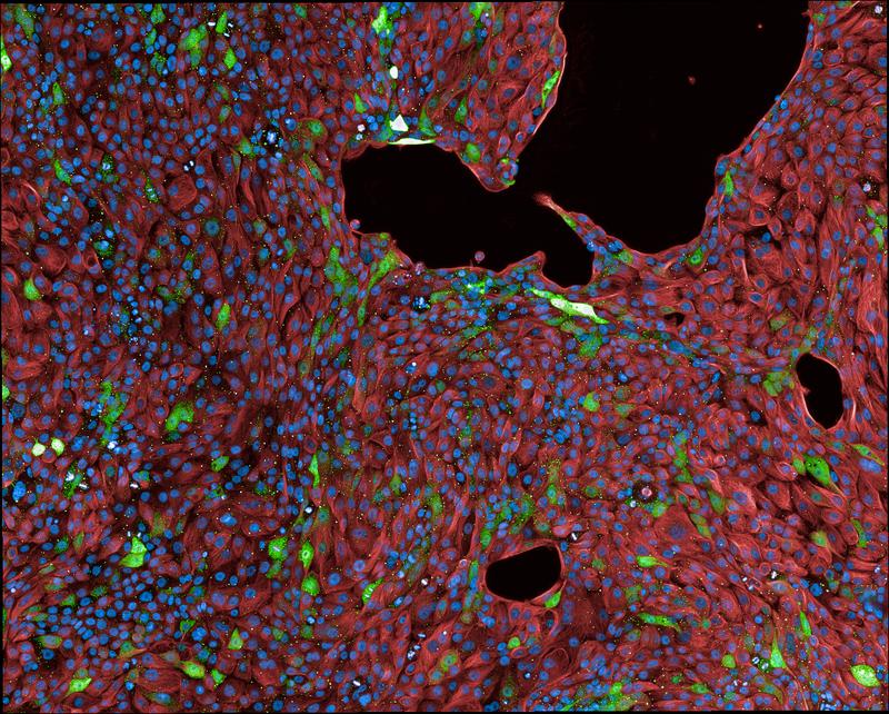 Eine Zelllinie des Lungenepithels mit Membranen (rot) und Kernen (blau). Zellen, die als Reaktion auf eine SARS-CoV-2-Infektion das fluoreszierende Protein herstellen, leuchten grün. 