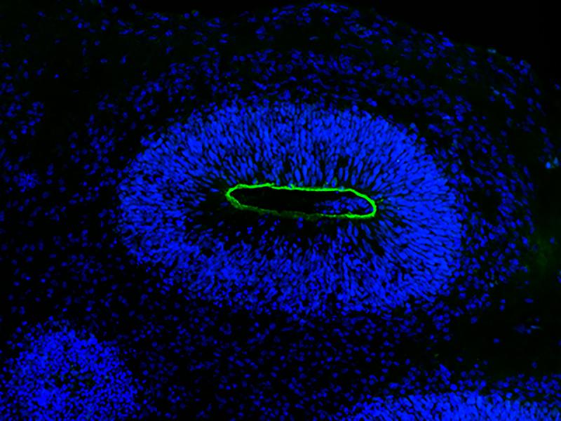 Zum Vergleich ein gesundes Kontroll-Organoid. 