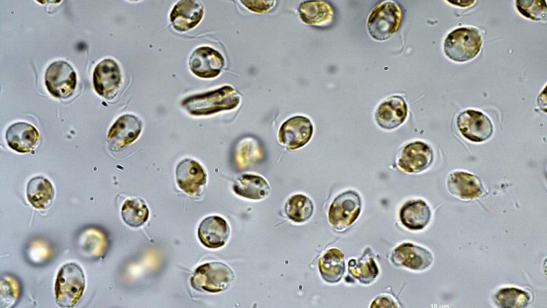 Die Goldalge Prymnesium parvum unter dem Mikroskop. 