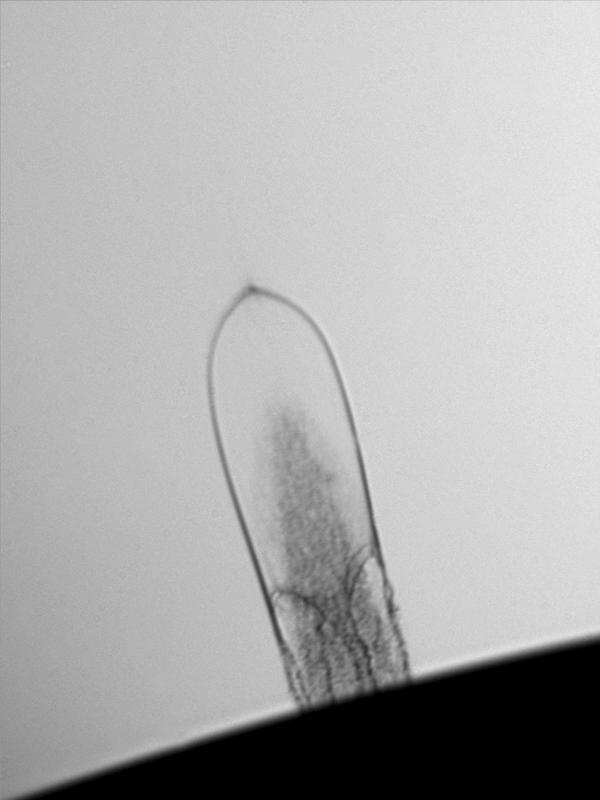  Das Bild zeigt eine lasererzeugte Oberflächenblase aus flüssigem Glycerin, die zweieinhalb Mikrosekunden lang in Bewegung war und sich um etwa 600 Mikrometer ausgedehnt hat. 