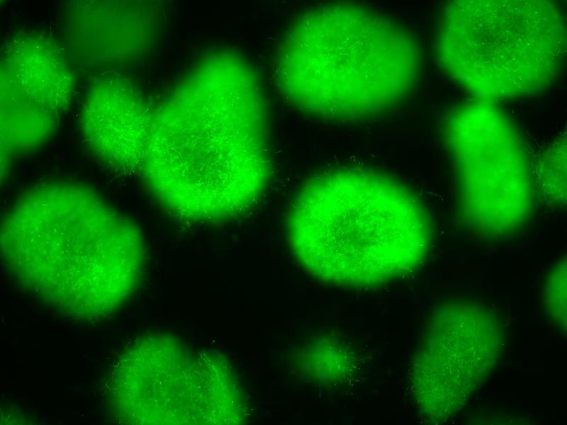 Dieser Aspergillus nidulans-Reporterstamm produziert grün fluoreszierendes Protein (GFP), wenn ein bestimmtes Gencluster aktiviert wird. Das passiert, wenn ein bestimmtes Arginoketid zugegeben wird.