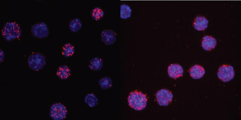 C/EBPαR35A  interagiert stärker mit PU.1 als unverpaartes C/EBPα. Die Zellkerne sind hellblau, die Interaktionsergebnisse als rote Punkte sichtbar. Bei der  Mutante (rechts) sind wesentlich mehr Zellen aktiviert als beim Wildtyp. 